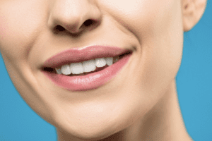 7 Cara Memutihkan Gigi Secara Alami dengan Mudah di Rumah