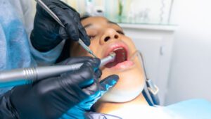Biaya Cabut Gigi di Puskesmas dan Klinik Gigi