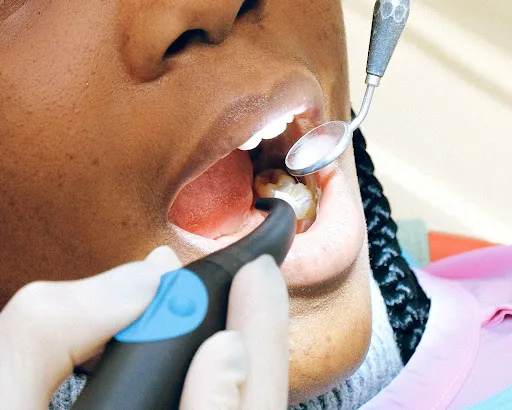 Klinik Gigi Cabut Gigi Bungsu Klinik Gigi SATU Dental