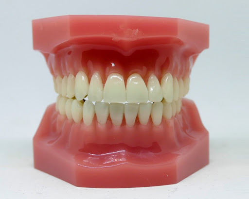 Penyebab Akar Gigi Menjadi Busuk dan Cara Mengobatinya