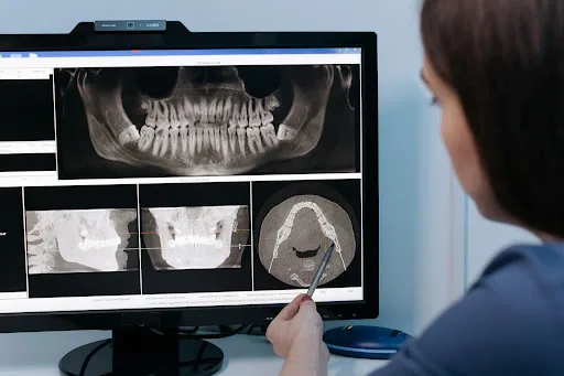 5. Panoramic X-Ray