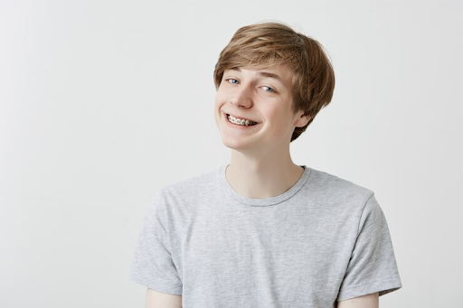Apa Itu Self Ligating Braces? Harga dan Perbedaan dengan Conventional Braces