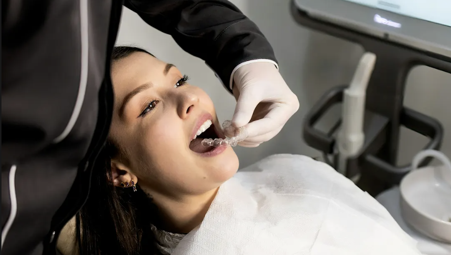 7 Tips Persiapan Sebelum Bleaching Gigi, Prosedur dan Manfaat Bleaching Gigi