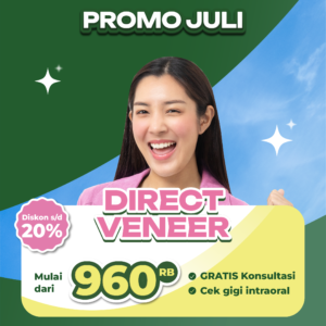 Promo Direct Veneer Mulai dari 960rb