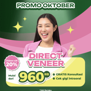 Promo Direct Veneer Mulai dari 960RB
