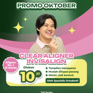 Promo Clear Aligner Invisalign Diskon 10JT