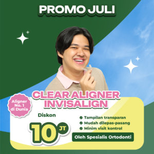 Promo Clear Aligner Invisalign Diskon 10jt