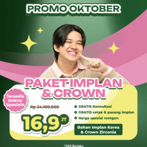 Promo Paket Implan & Crown