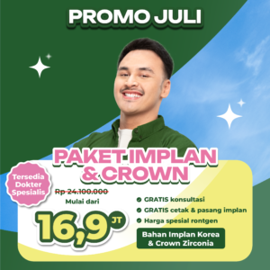 Promo Paket Implan & Crown