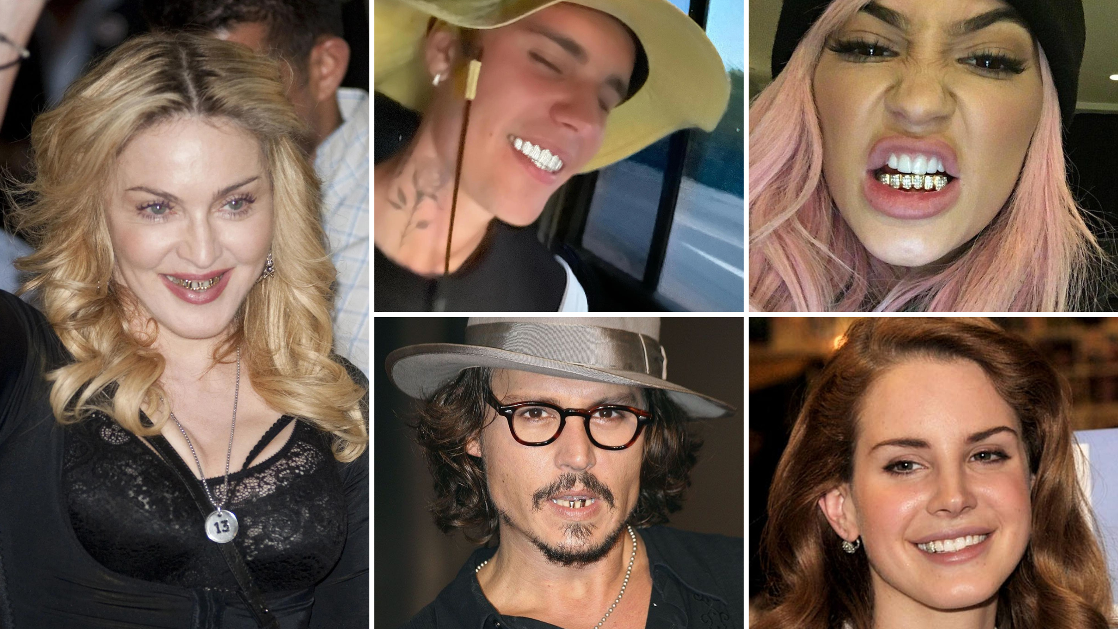 5 Artis Hollywood Pasang Gigi Emas