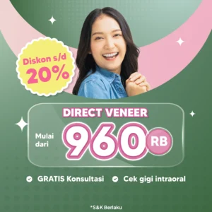 Promo Direct Veneer Mulai dari 960rb