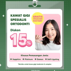 Promo Kawat Gigi Spesialis Ortodonti 15%