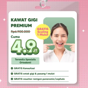 Promo Kawat Gigi Premium 4,9jt