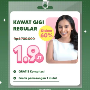Promo Kawat Gigi Reguler 1,9jt
