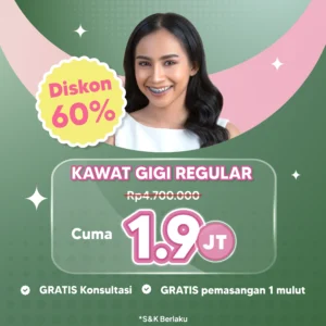 Promo Kawat Gigi Regular Cuma 1,9jt Semarang
