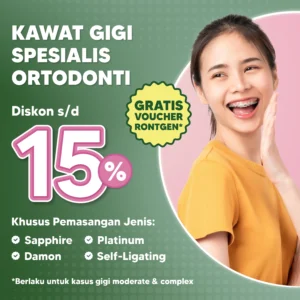 Promo Kawat Gigi Spesialis Ortodonti Diskon s/d 15%
