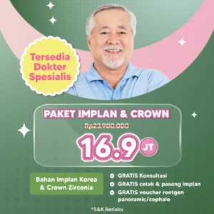 Promo Paket Implan & Crown