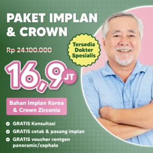 Promo Paket Implan & Crown
