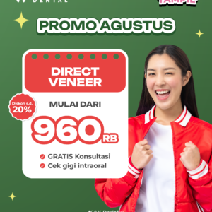 Promo Direct Veneer Mulai dari 960rb Semarang