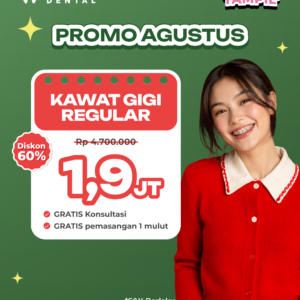 Promo Kawat Gigi Reguler Cuma 1,9jt Surabaya