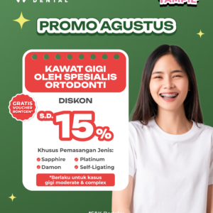 Promo Kawat Gigi Spesialis Ortodonti Diskon s/d 15% Surabaya