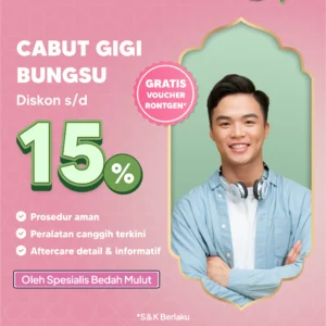 Promo Cabut Gigi Bungsu