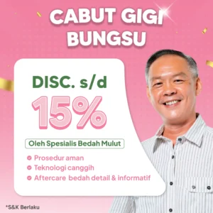 Promo Cabut Gigi Bungsu