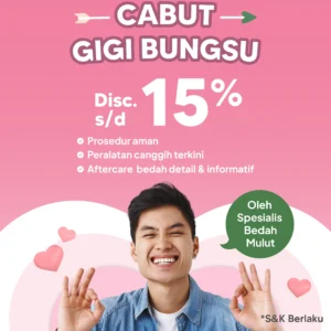 Promo Cabut Gigi Bungsu s/d 15%
