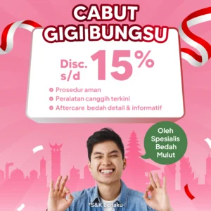 Promo Cabut Gigi Bungsu s/d 15%