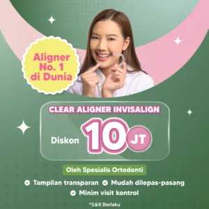 Promo Clear Aligner Invisalign Diskon 10jt