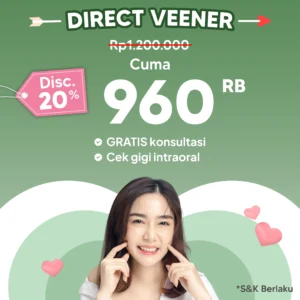 Promo Direct Veneer 20%