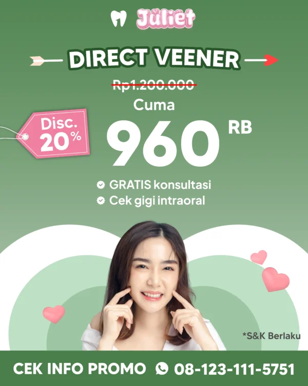 Promo Direct Veneer 20%