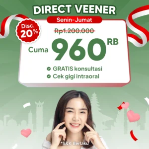 Promo Direct Veneer 20%