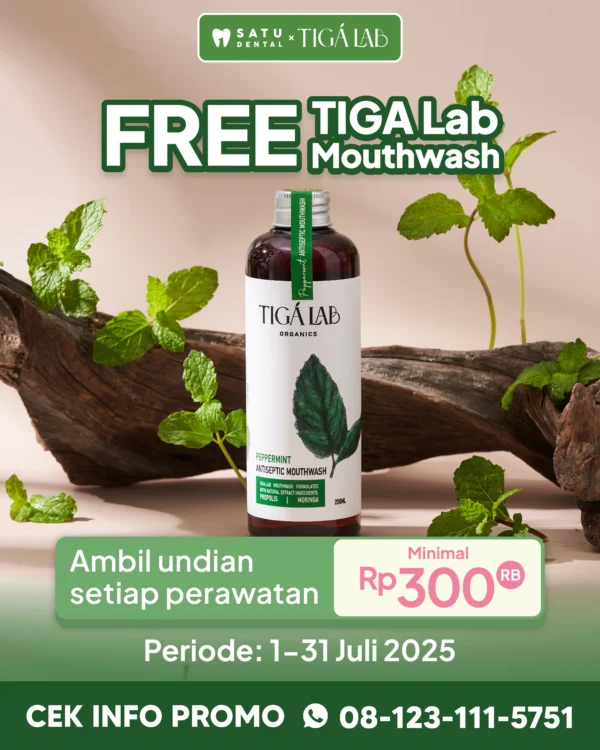 Promo SATU Dental X Tiga Lab Undian