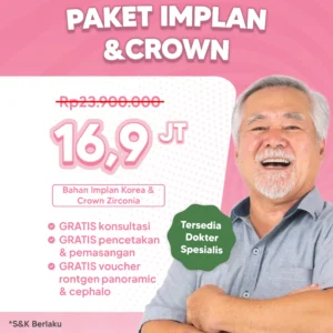 Promo Paket Implan & Crown