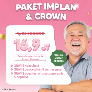 Promo Paket Implan & Crown