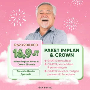 Promo Paket Implan & Crown
