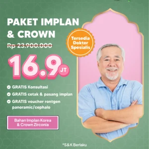 Promo Paket Implan & Crown