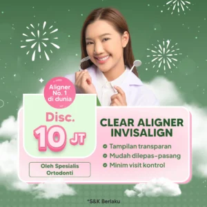 Promo Clear Aligner Invisalign