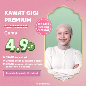 Promo Kawat Gigi Premium 4,9jt