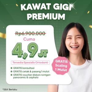 Promo Kawat Gigi Premium 4,9jt