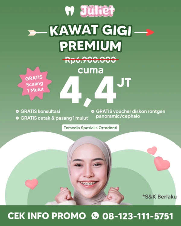 Promo Kawat Gigi Premium 4,4jt