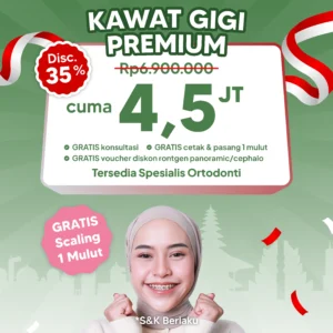 Promo Kawat Gigi Premium 4,4jt