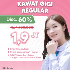 Promo Kawat Gigi Reguler 1,9jt