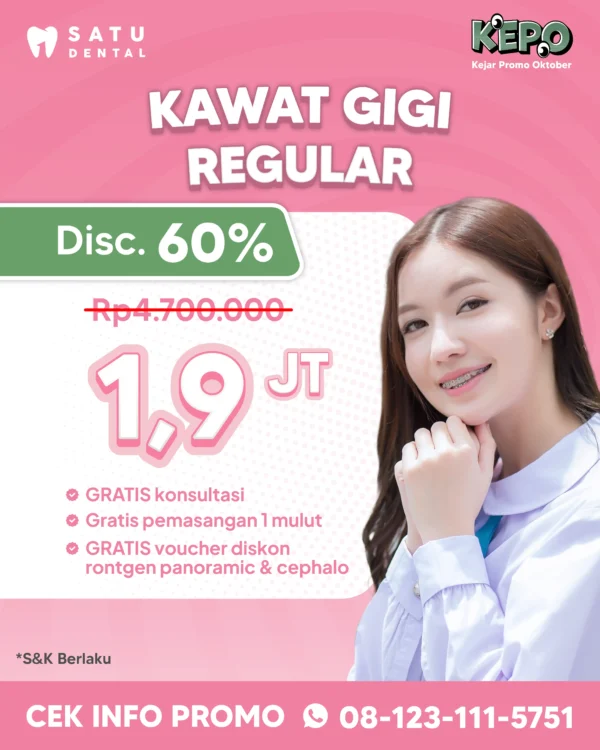 Promo Kawat Gigi Reguler 1,9jt