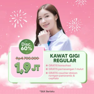 Promo Kawat Gigi Reguler 1,9jt