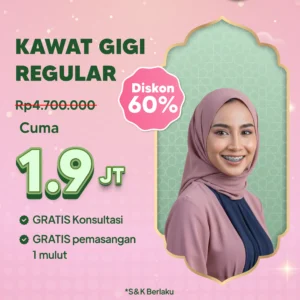 Promo Kawat Gigi Reguler 1,9jt