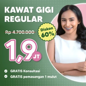 Promo Kawat Gigi Reguler Cuma 1,9jt