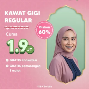 Promo Kawat Gigi Reguler 1,9jt