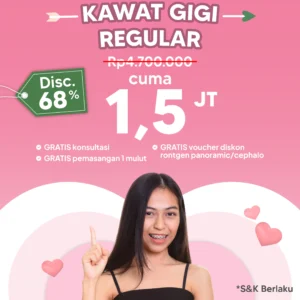 Promo Kawat Gigi Reguler 1,5jt